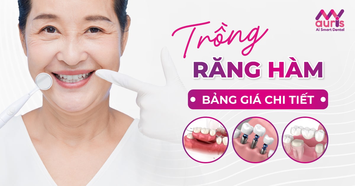 Trồng răng hàm mất bao nhiêu tiền?