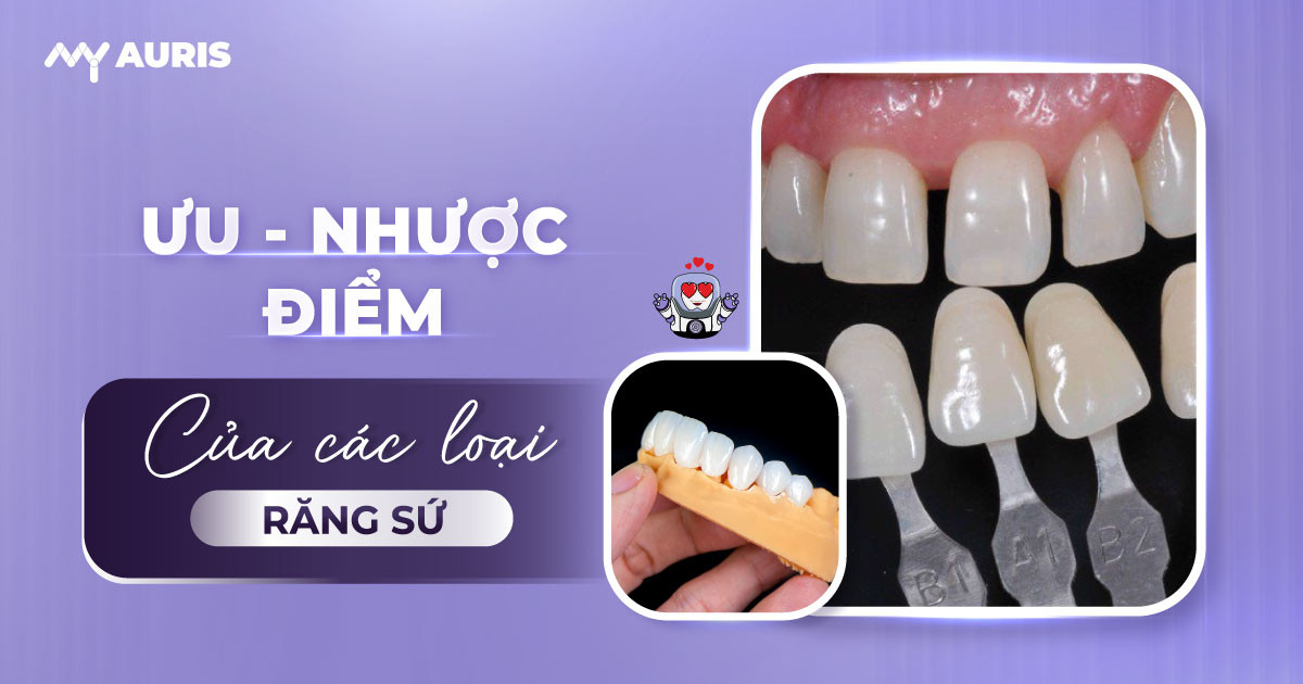 răng sứ,ưu và nhược điểm của các loại răng sứ, ưu nhược điểm của răng sứ kim loại