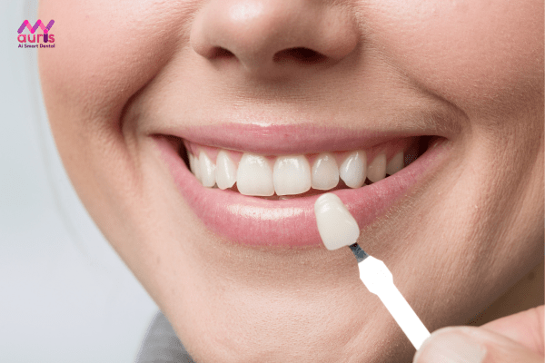 Khi vỡ răng sứ phải khắc phục như thế nào?