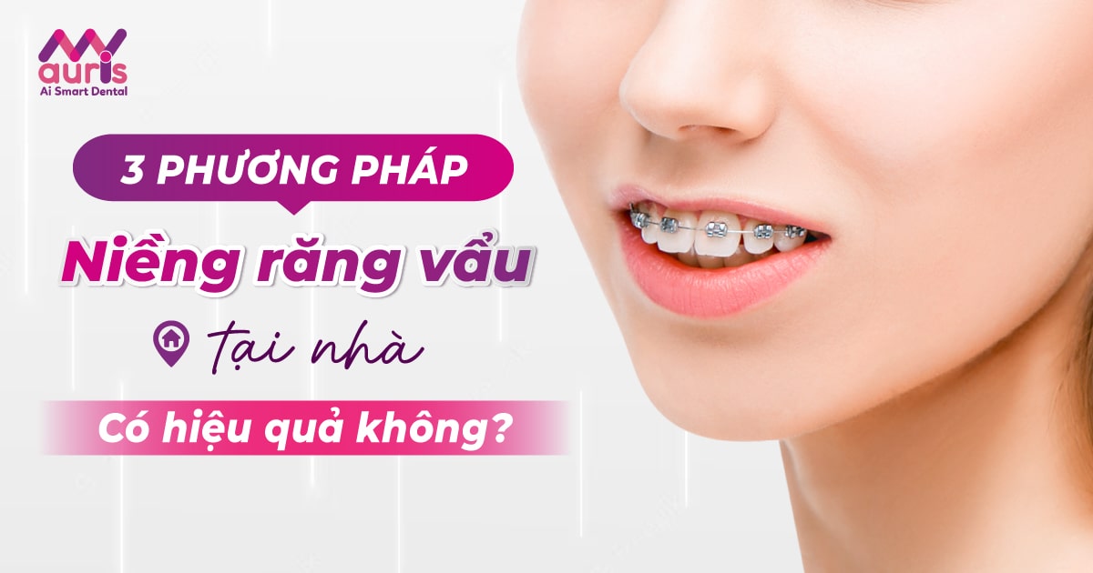 3 phương pháp niềng răng vẩu tại nhà