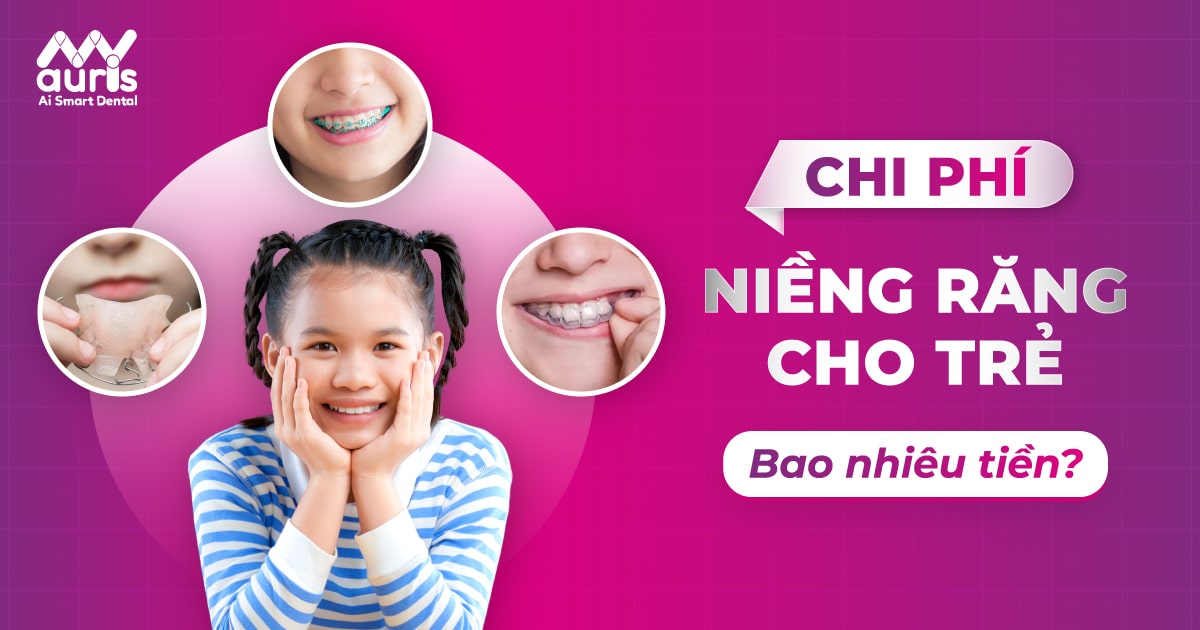 chi phí niềng răng cho trẻ