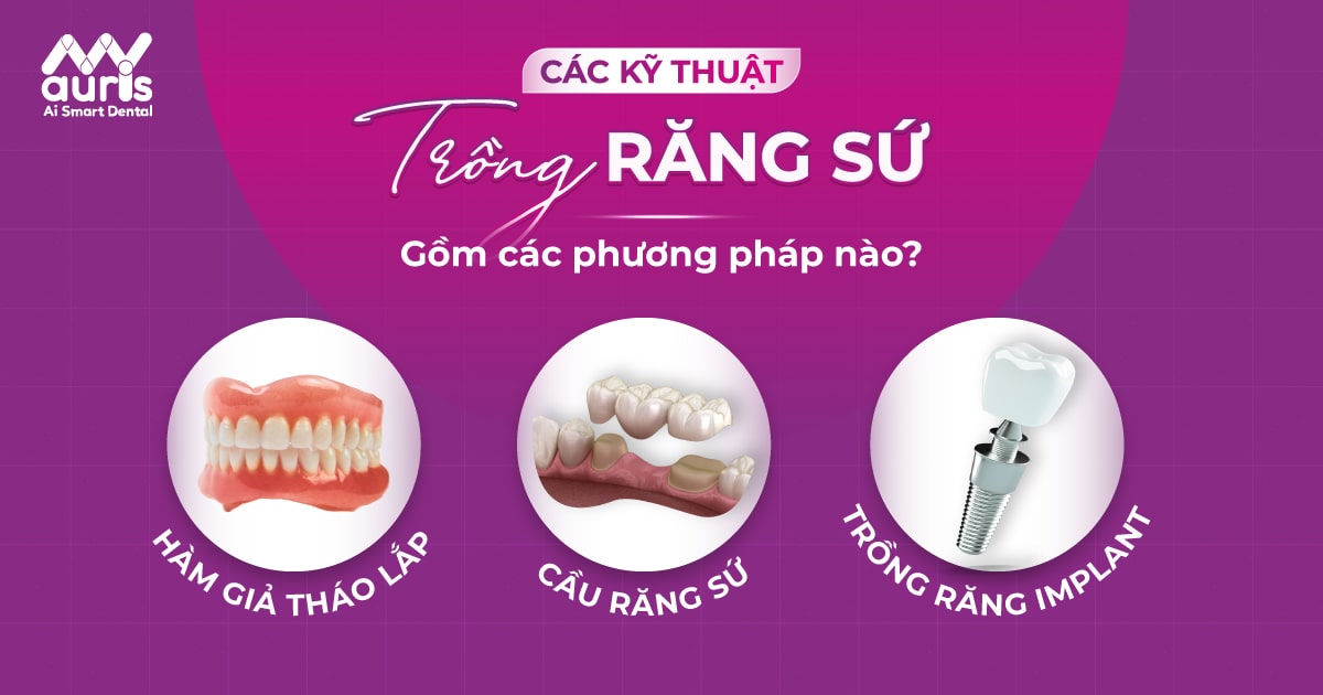 kỹ thuật trồng răng sứ