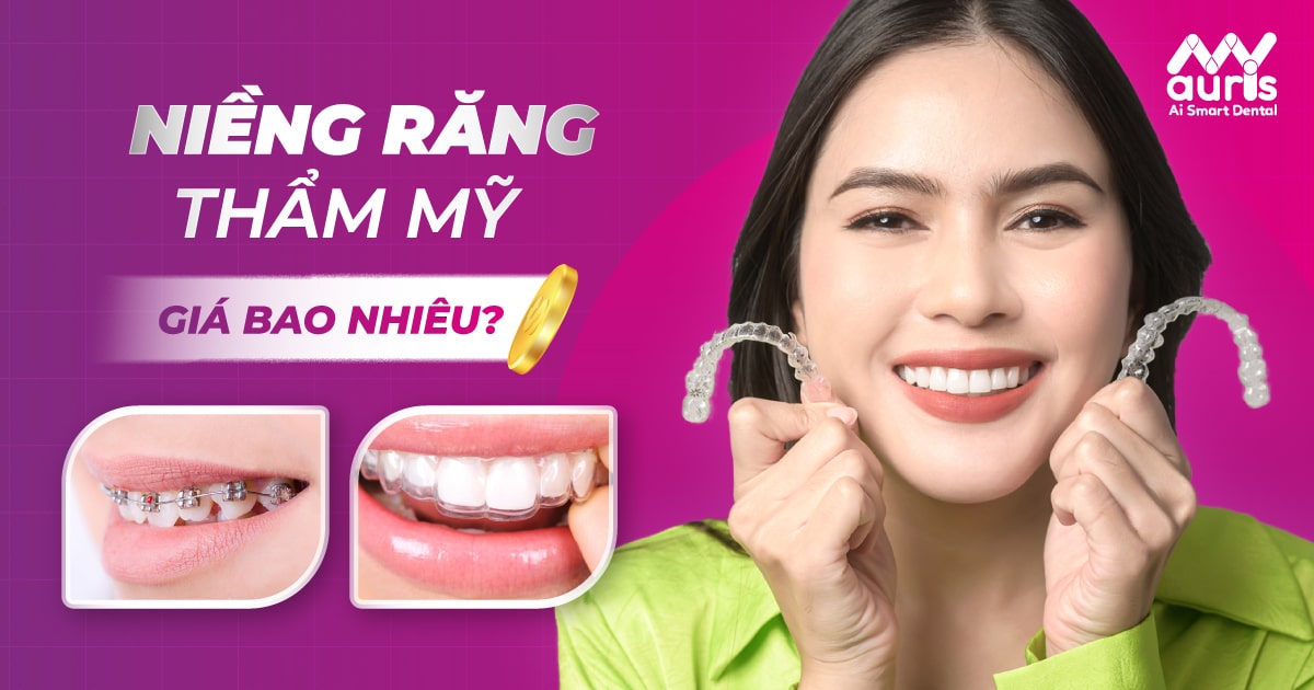 niềng răng thẩm mỹ giá