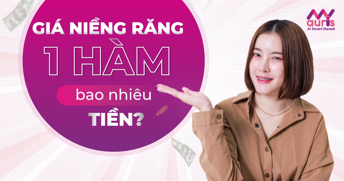 giá cả niềng răng 1 hàm bao nhiêu tiền