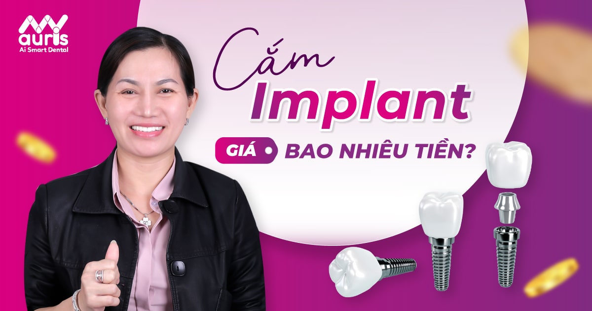 cắm implant giá bao nhiêu