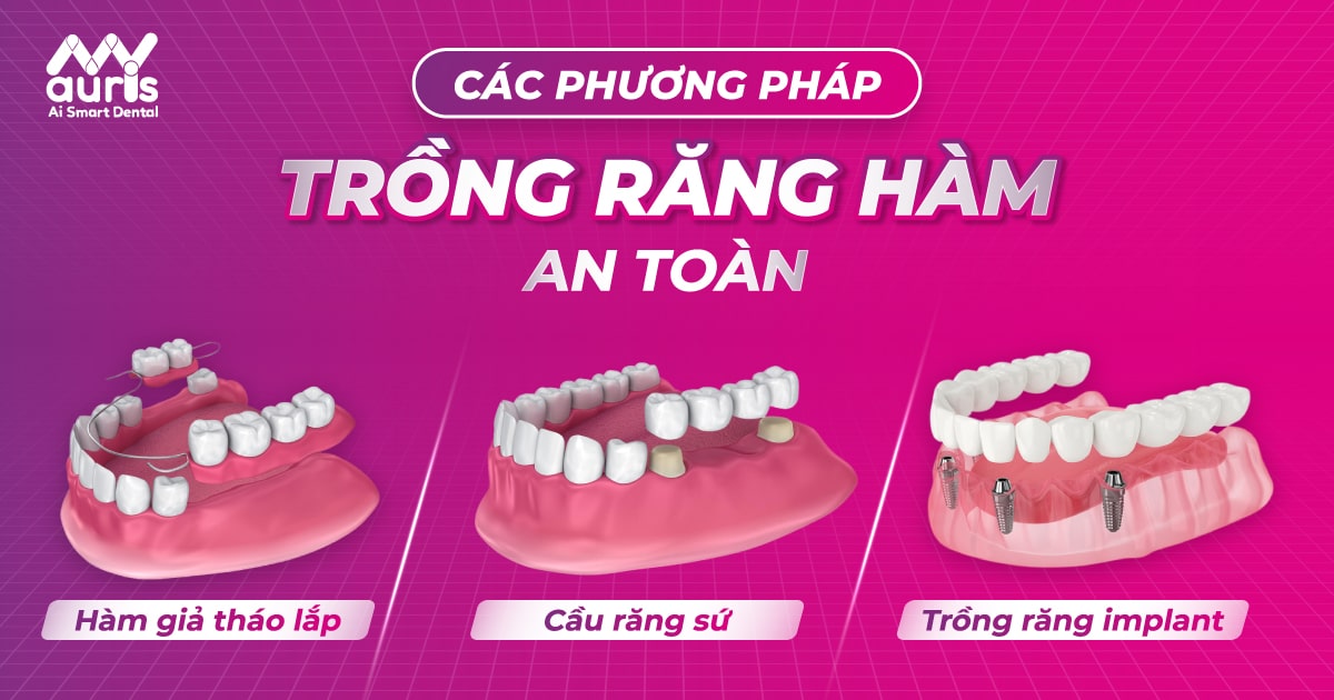 trồng răng hàm an toàn