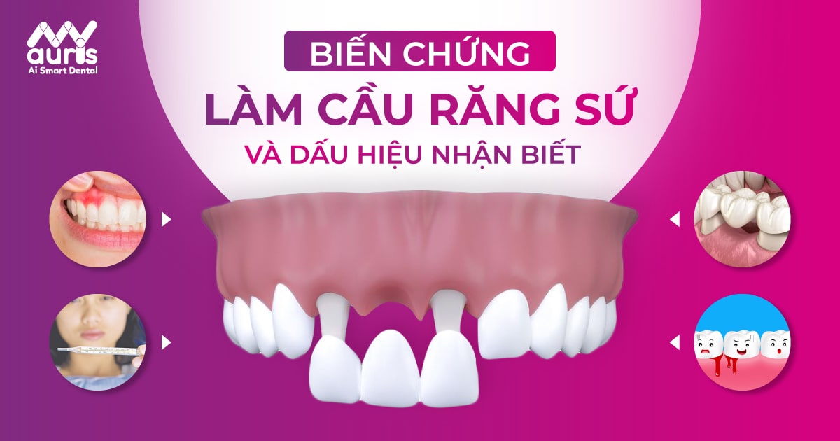 biến chứng làm cầu răng sứ