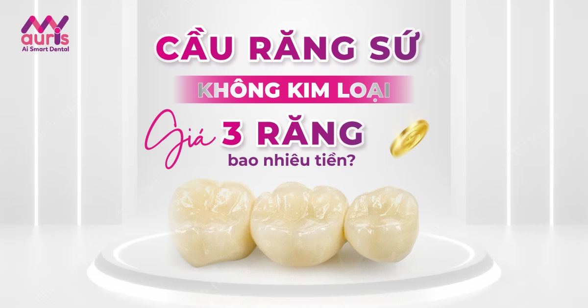 cầu răng sứ không kim loại giá 3 răng