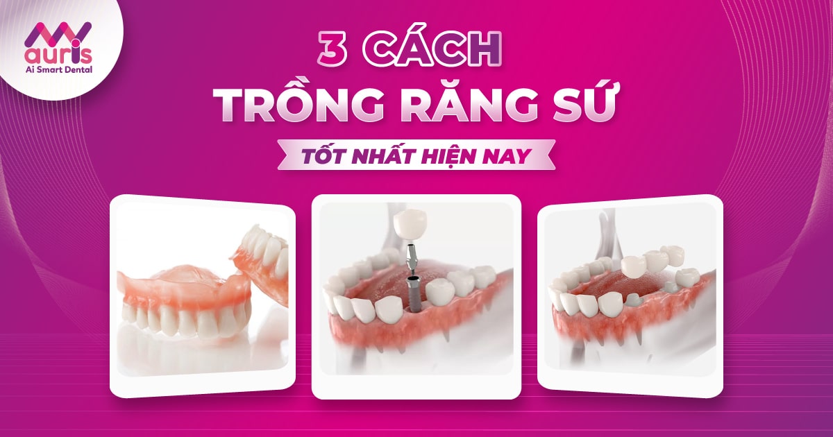 cách trồng răng sứ giả tốt nhất