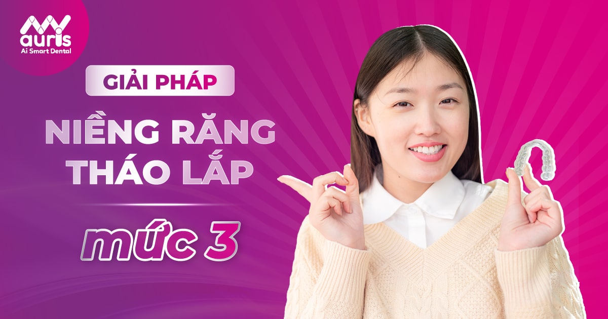 niềng răng tháo lắp mức 3