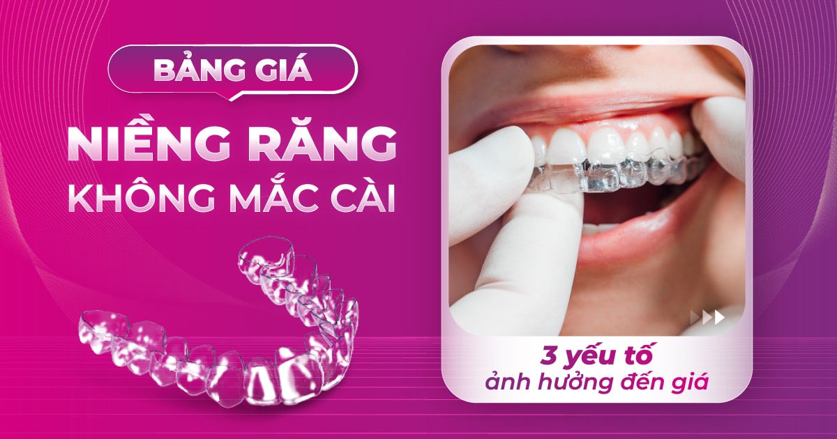 bảng giá niềng răng không mắc cài