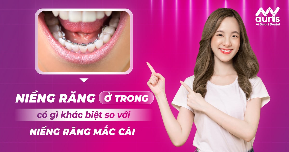 niềng răng ở trong