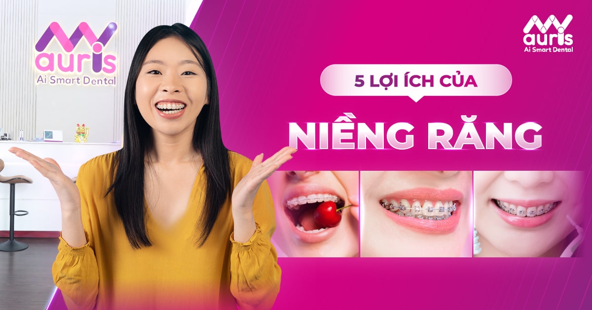 5 lợi ích của việc niềng răng