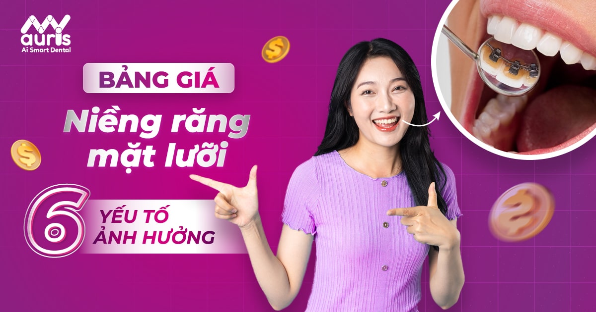 Bảng giá niềng răng mặt lưỡi - 6 yếu tố ảnh hưởng chi phí