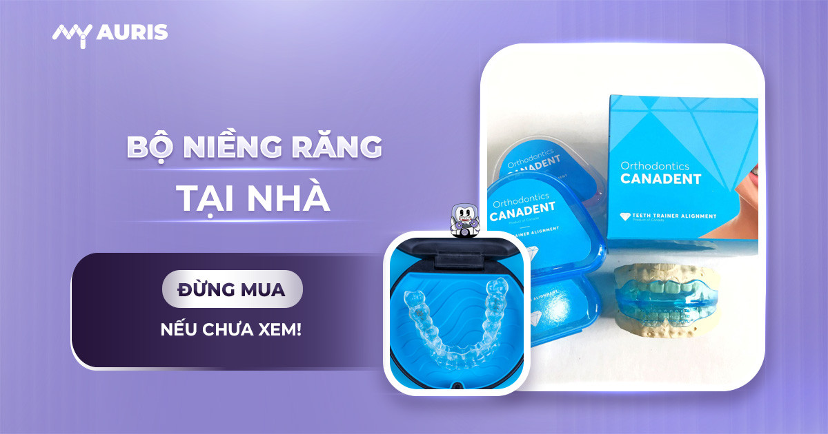 bộ niềng răng tại nhà,giá bộ niềng răng tại nhà,giá niềng răng trainer,hàm niềng răng tại nhà,niềng răng ở nhà