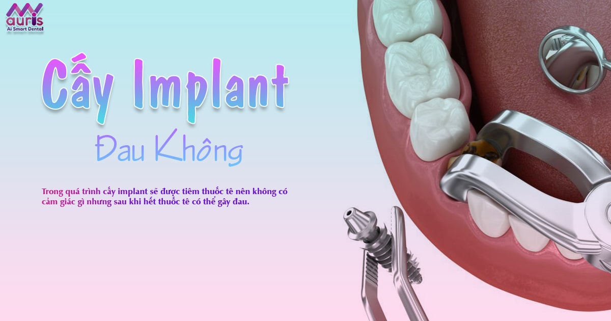 cấy implant đau không