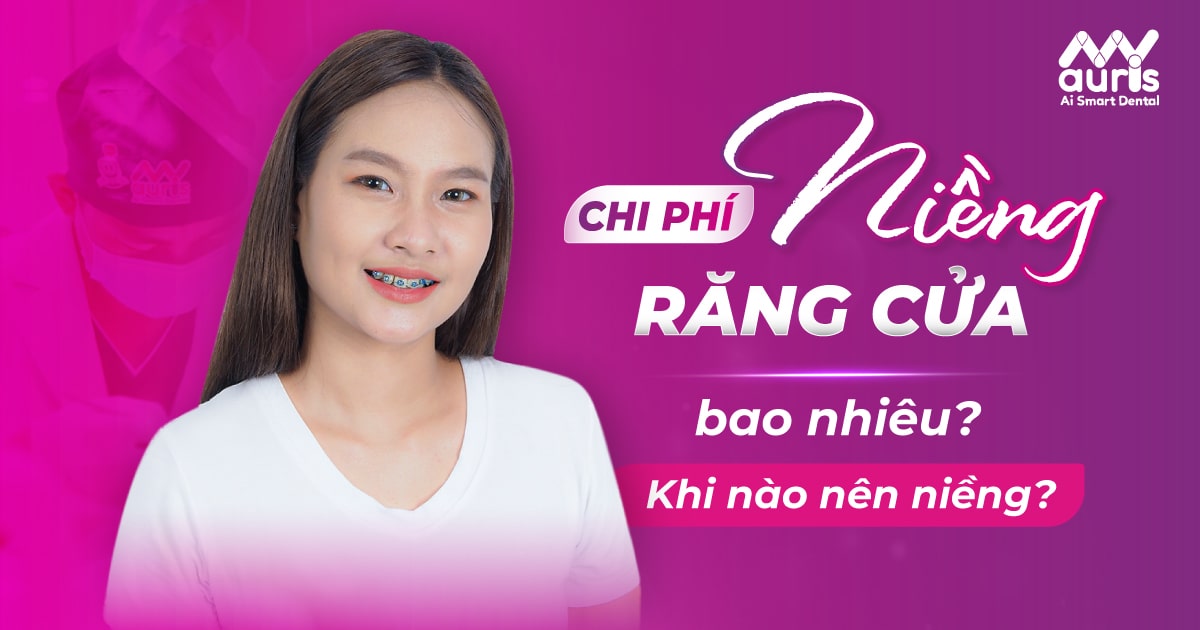 Chi phí niềng răng cửa bao nhiêu