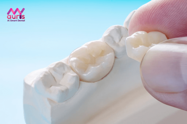 Phục hình răng sứ cho từng trường hợp sâu răng
