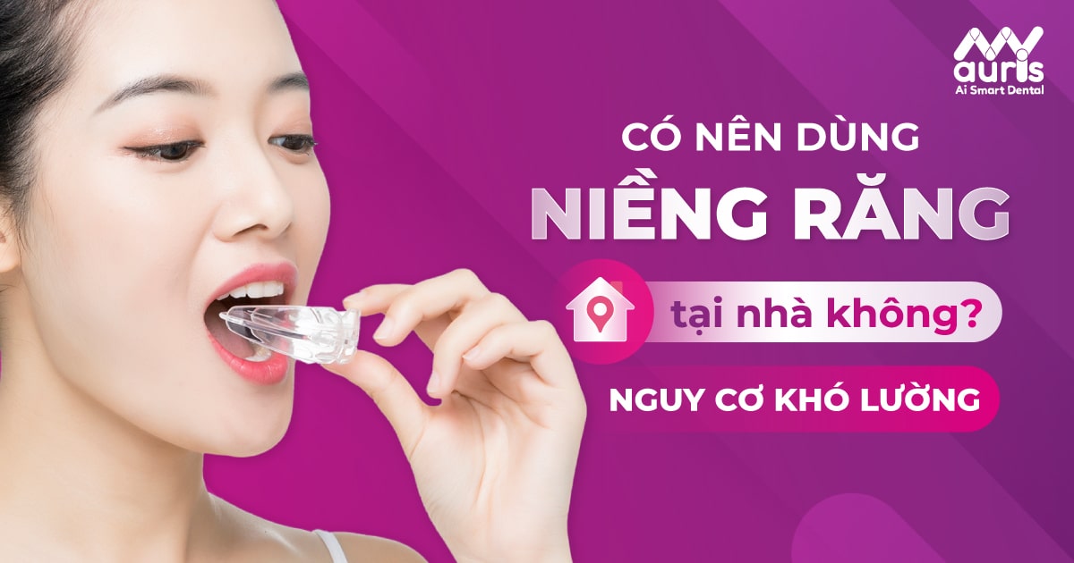 Có nên dùng niềng răng tại nhà không