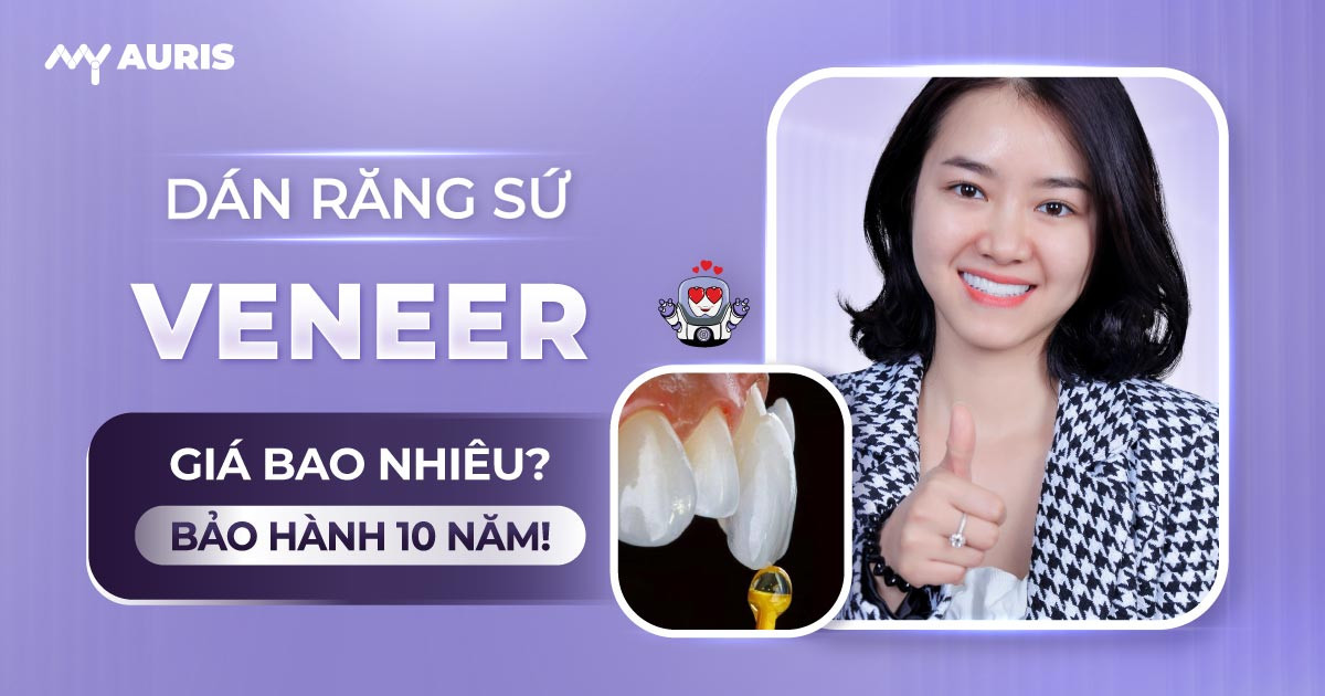 dán răng sứ veneer giá bao nhiêu,răng sứ veneer,dán răng sứ,dán răng sứ giá bao nhiêu,dán răng sứ veneer