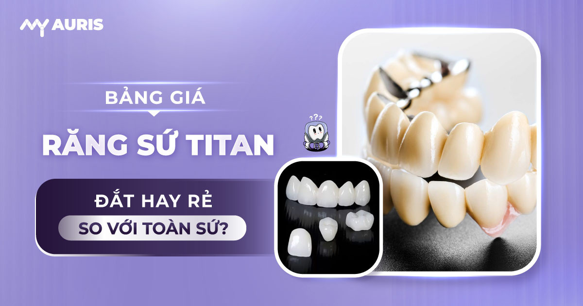 giá bọc răng sứ titan,bọc răng sứ titan giá bao nhiêu,răng sứ titan giá bao nhiêu tiền