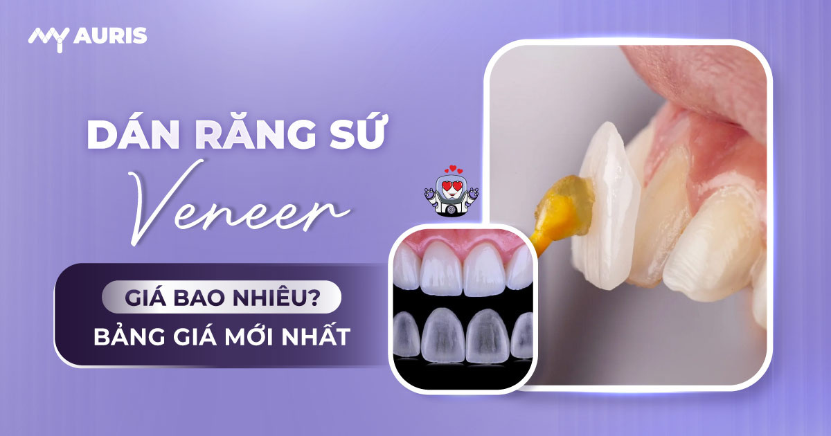 giá dán răng sứ veneer,bảng giá dán răng sứ veneer