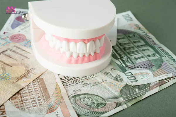 Giá tiền trồng răng giả cố định 