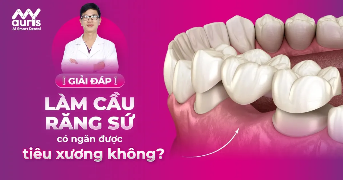 [GIẢI ĐÁP] Làm cầu răng sứ có ngăn được tiêu xương không?