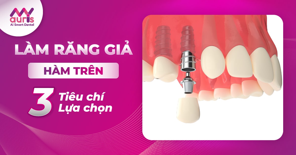 Làm răng giả hàm trên - 3 tiêu chí lựa chọn phù hợp