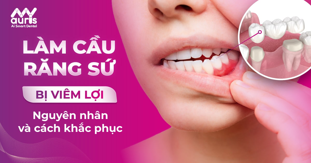 Làm cầu răng sứ bị viêm lợi