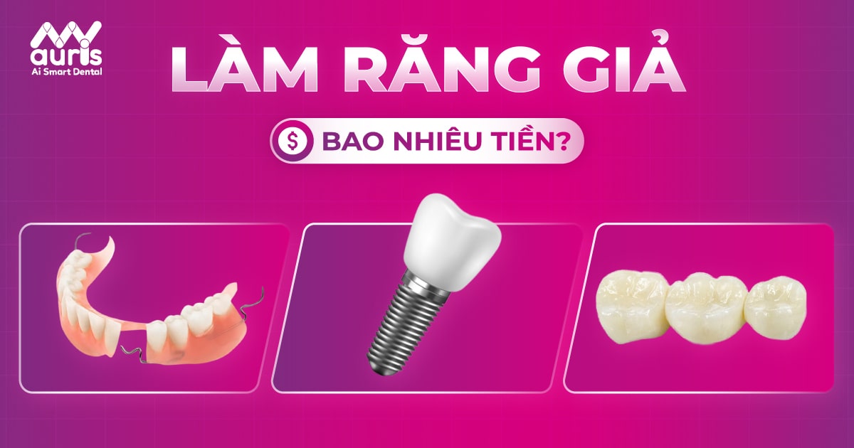 Làm răng giả hết bao nhiêu tiền? (Chỉ từ 3 TRIỆU)