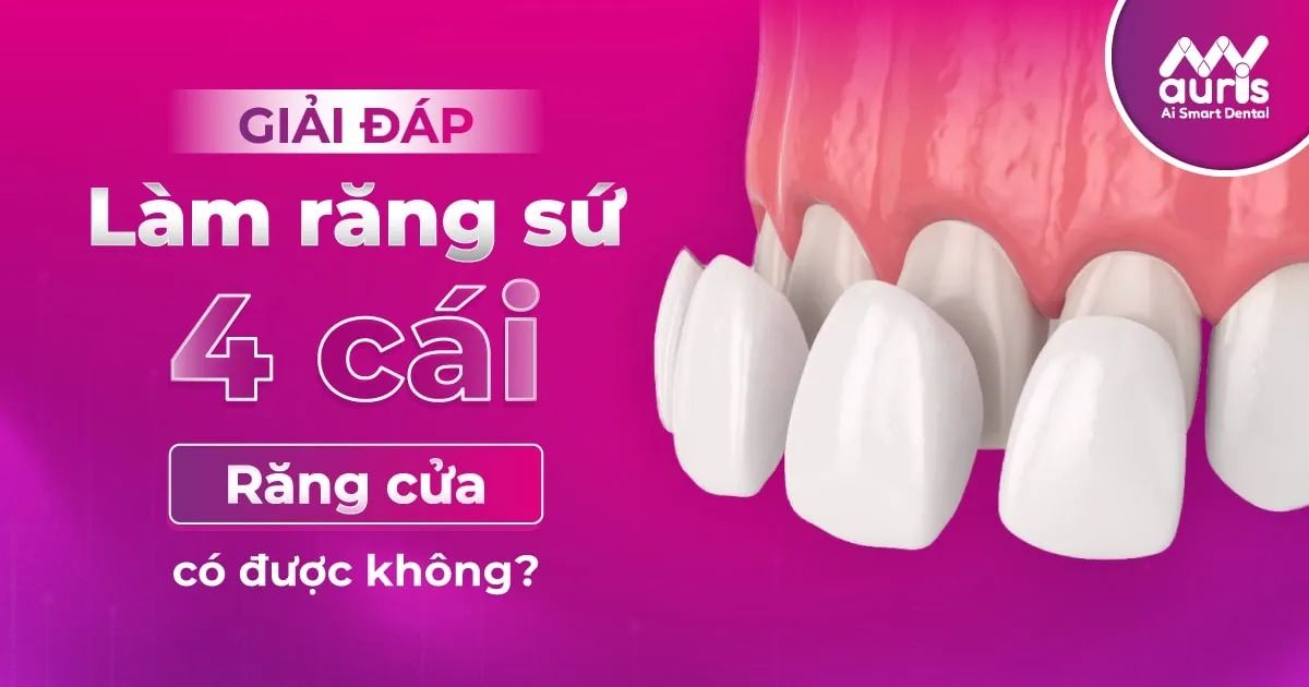 Làm răng sứ 4 cái răng cửa có được không?