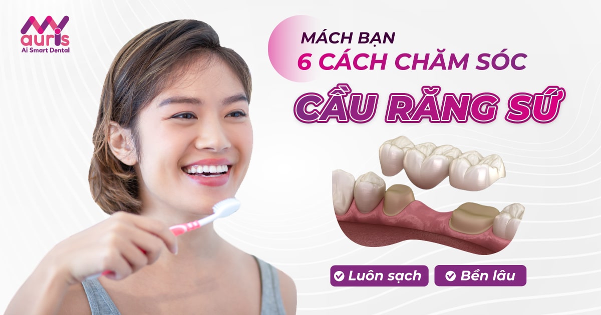 Mách bạn 6 cách chăm sóc cầu răng sứ luôn sạch, bền lâu