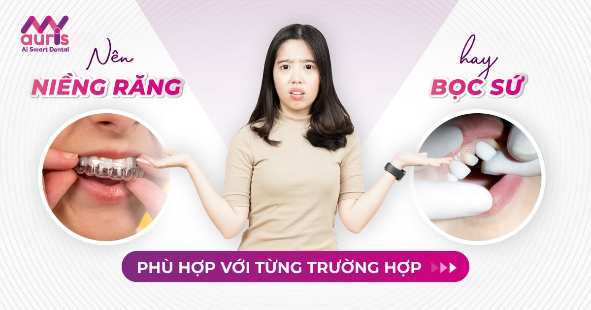 Nên niềng răng hay bọc sứ phù hợp với từng trường hợp