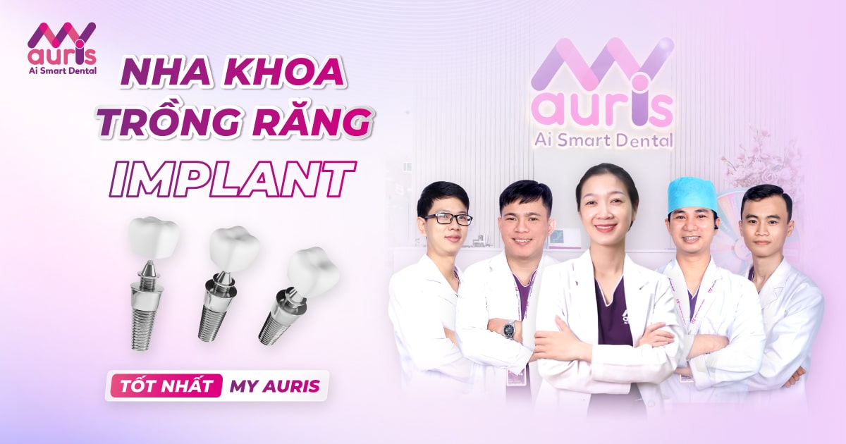 Nha khoa trồng răng Implant tốt nhất - Đánh giá 7 tiêu chí