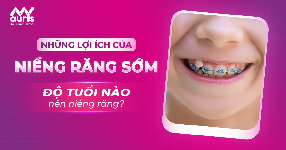 Những lợi ích của niềng răng sớm