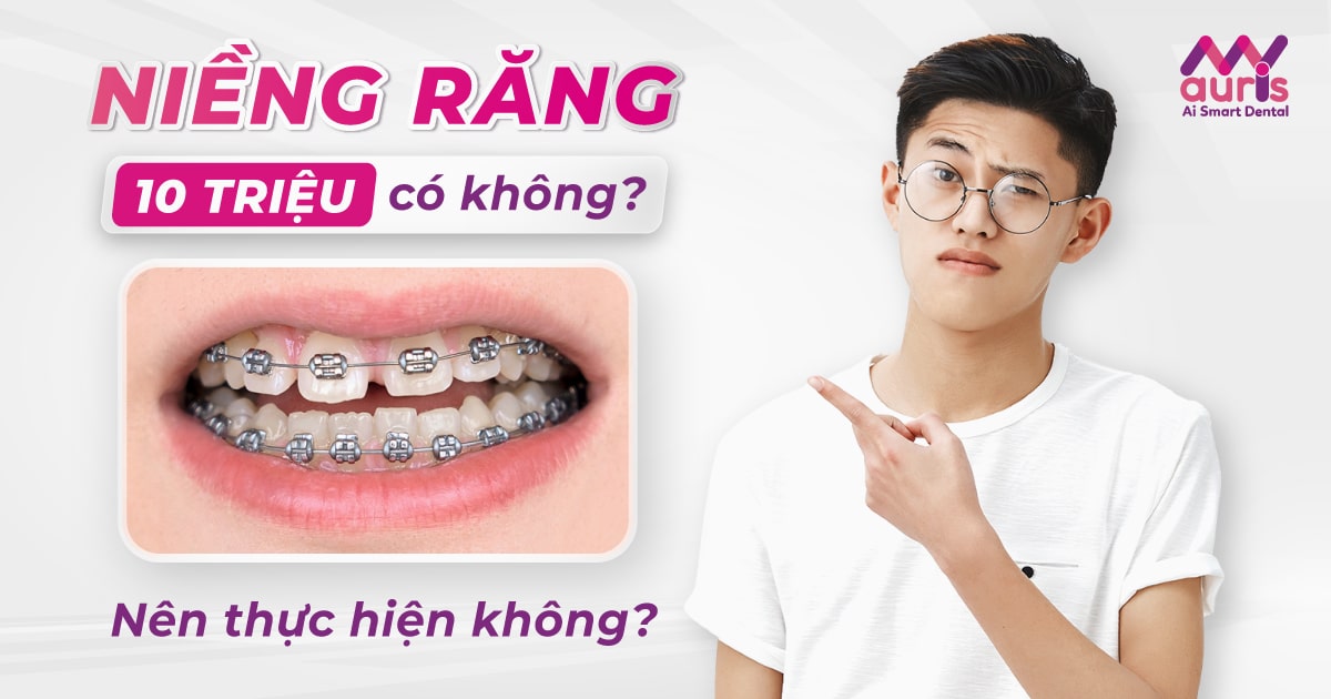 Niềng răng 10 triệu có không?