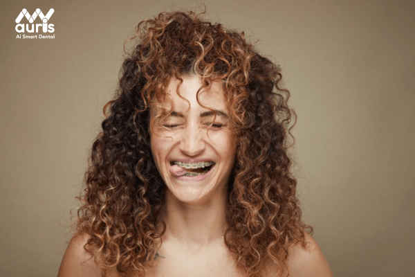Niềng răng bị hóp má và thái dương là tình trạng gì?