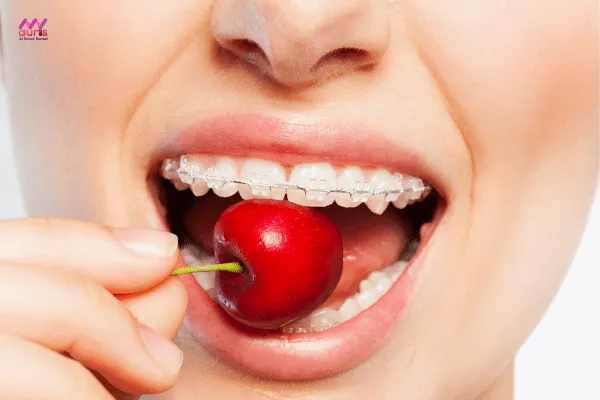 Do thói quen ăn nhai - Nguyên nhân niềng răng có bị hóp má