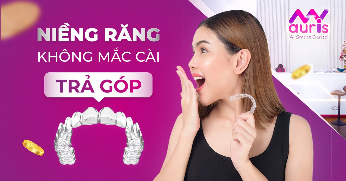 Niềng răng không mắc cài trả góp - 2 điểm cần lưu ý