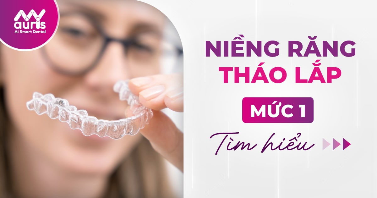 Niềng răng tháo lắp mức 1 là gì? Gồm các loại nào?