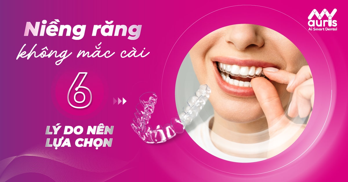 Phương pháp niềng răng không mắc cài - 6 lý do nên chọn