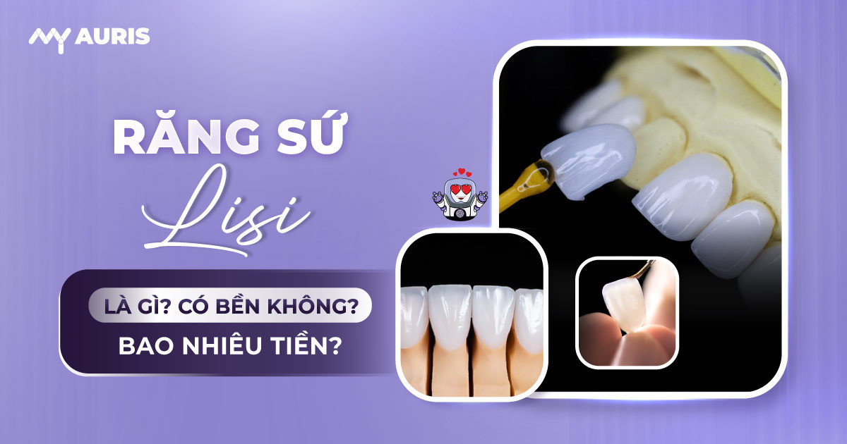 Răng sứ Lisi