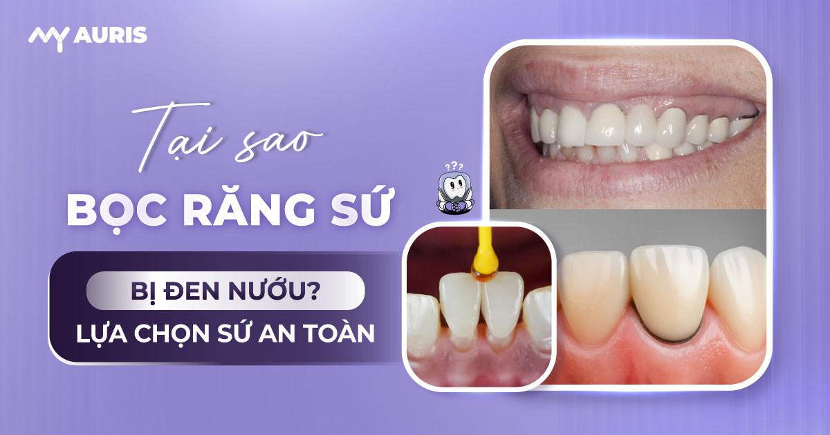 làm răng sứ bị thâm nướu