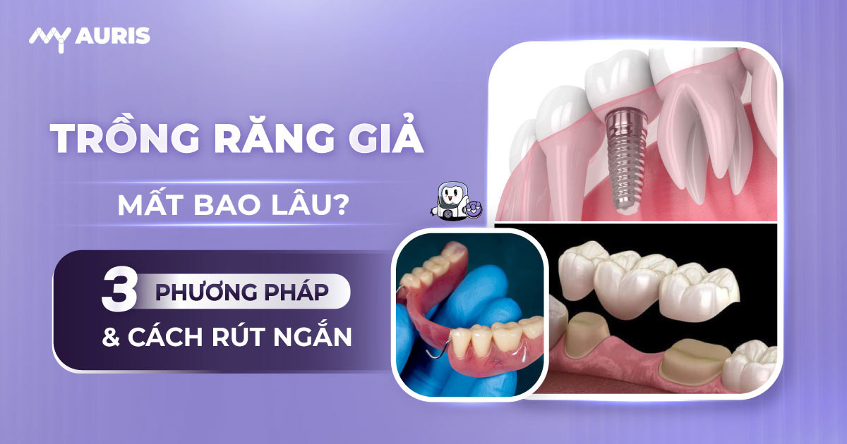 trồng răng giả mất bao lâu,trồng răng mất bao nhiêu thời gian,các bước trồng răng giả,làm răng giả dùng được bao lâu,trồng răng có lâu không,trồng răng giả được bao lâu,trồng răng hàm bao lâu