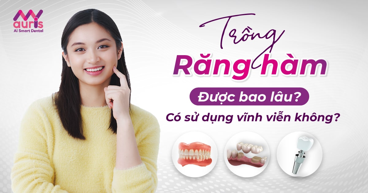 Trồng răng hàm được bao lâu?