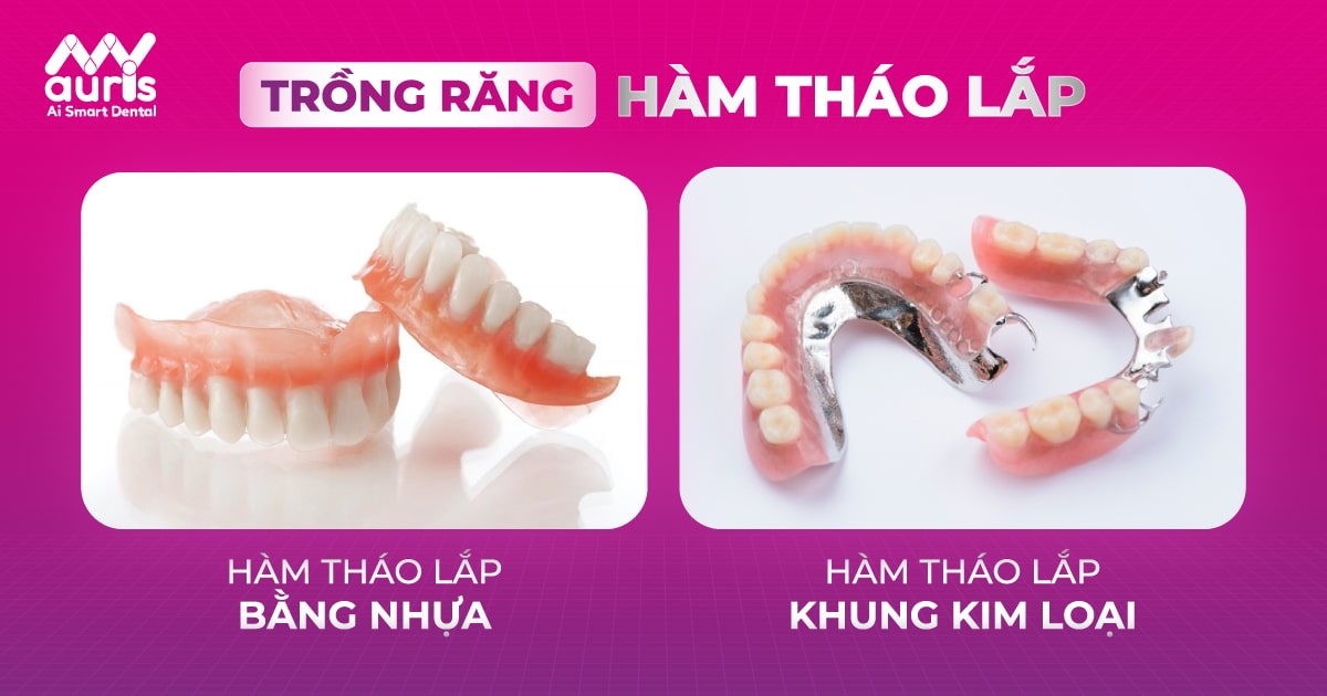 Trồng răng hàm giả tháo lắp - 2 loại và lưu ý thực hiện