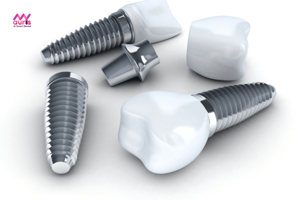 Về vật liệu chi phí trồng răng implant cao 