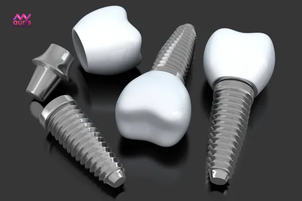 Trồng răng implant giá rẻ nhất bao nhiêu?