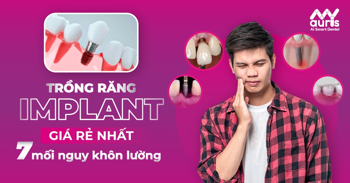 Trồng răng implant giá rẻ nhất